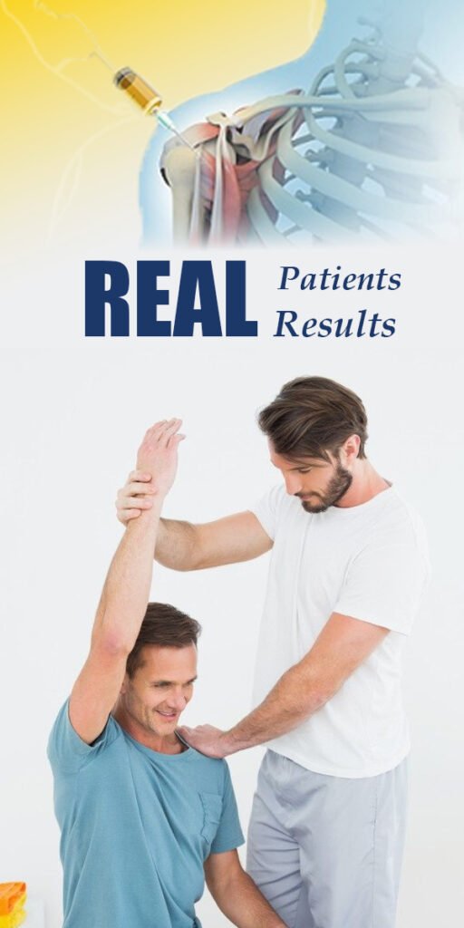 Patient undergoing physical therapy after PRP treatment for frozen shoulder recovery"