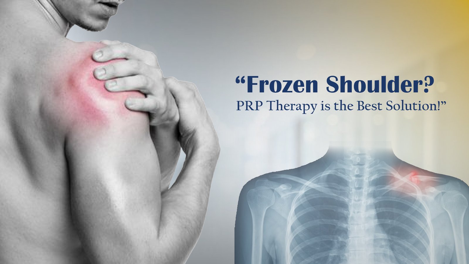 "Patient receiving PRP therapy for frozen shoulder pain relief"