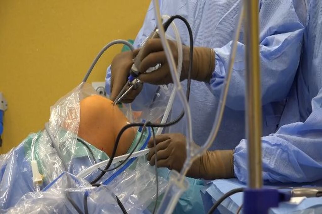 Non-Surgical procedure for Knee Pain