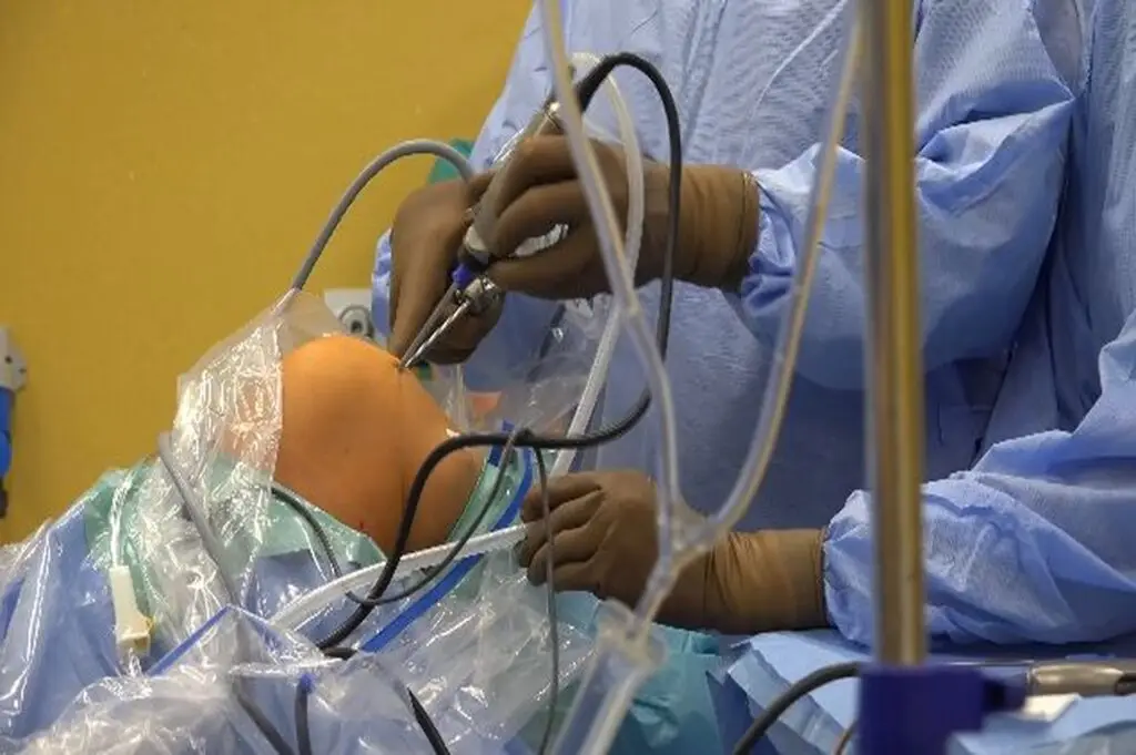 Non-Surgical procedure for Knee Pain