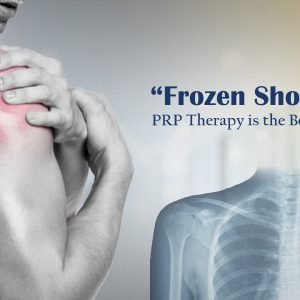 Experience lasting relief from frozen shoulder with advanced PRP therapy — a natural and effective solution for long-term shoulder pain.